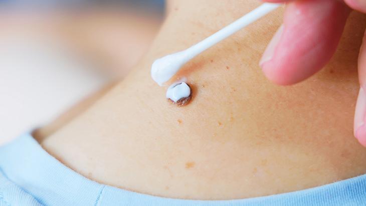 lazer de yaptiran da var solusyon suren de her ben masum degil incelenmeli hGB91NCg.jpg